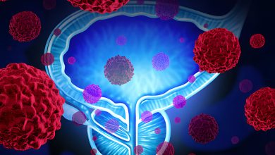 İdeal Prostat Boyutları