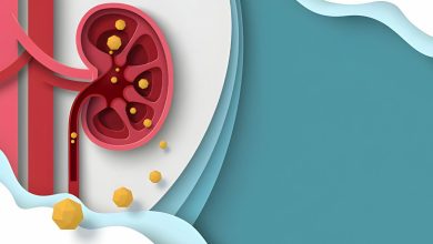 Böbrek Taşı Neden Olur?