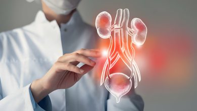 Divertikül Nedir? Mesane Divertikülü Nasıl Oluşur?