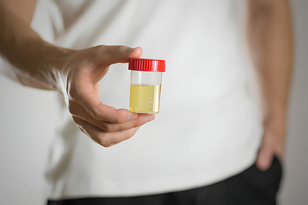 Kırmızı İdrar Rengi