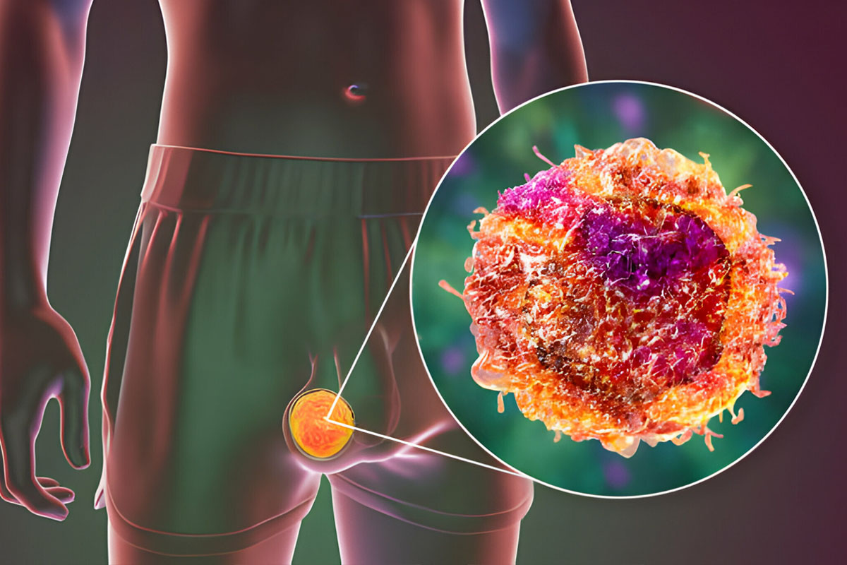 Leydig Hücreleri Ne İşe Yarar?