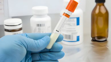 Sperm Örneği Nasıl Alınır?
