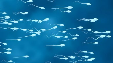 Sperm Şekil Bozukluğu