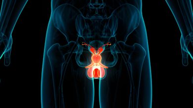 Testis Protezi