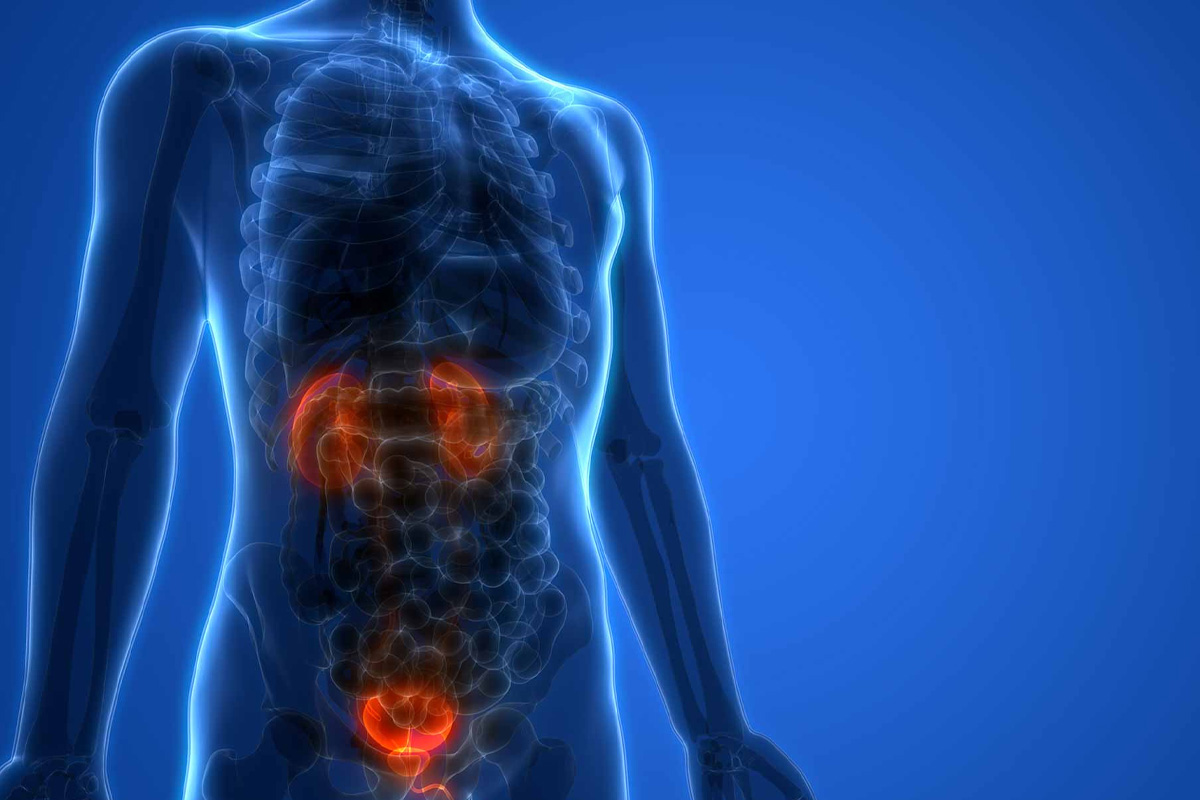 İnterstisyel Sistit Tedavisi