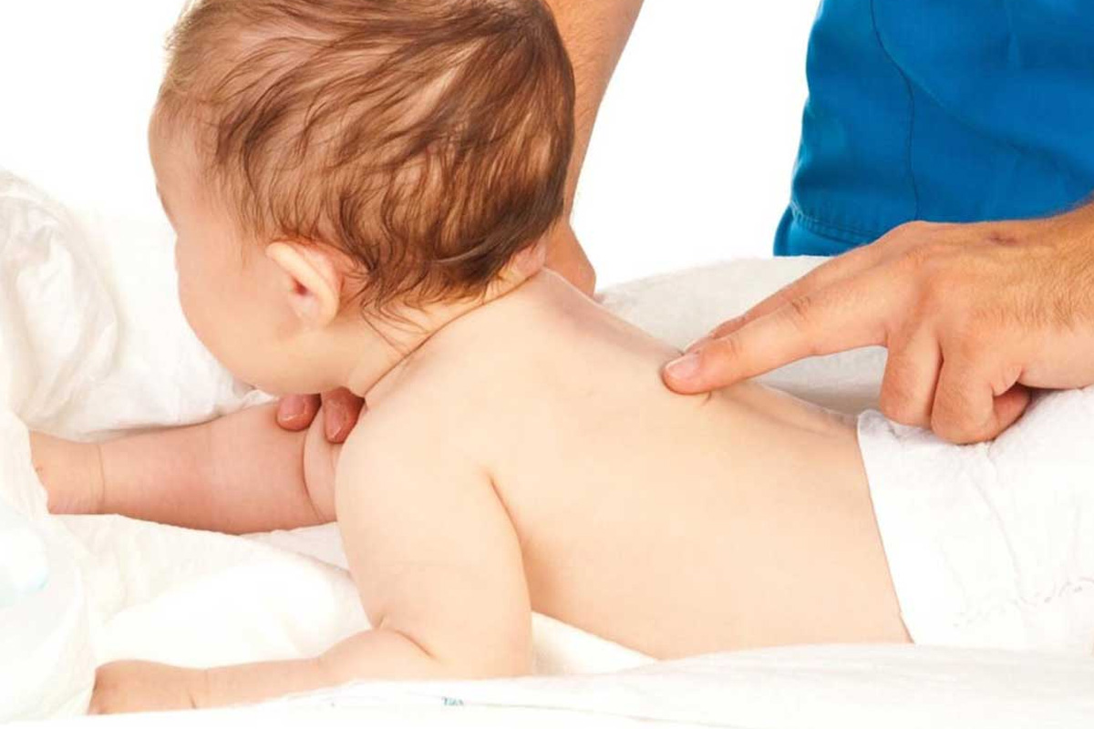 Doğumsal Anomali Belirtileri