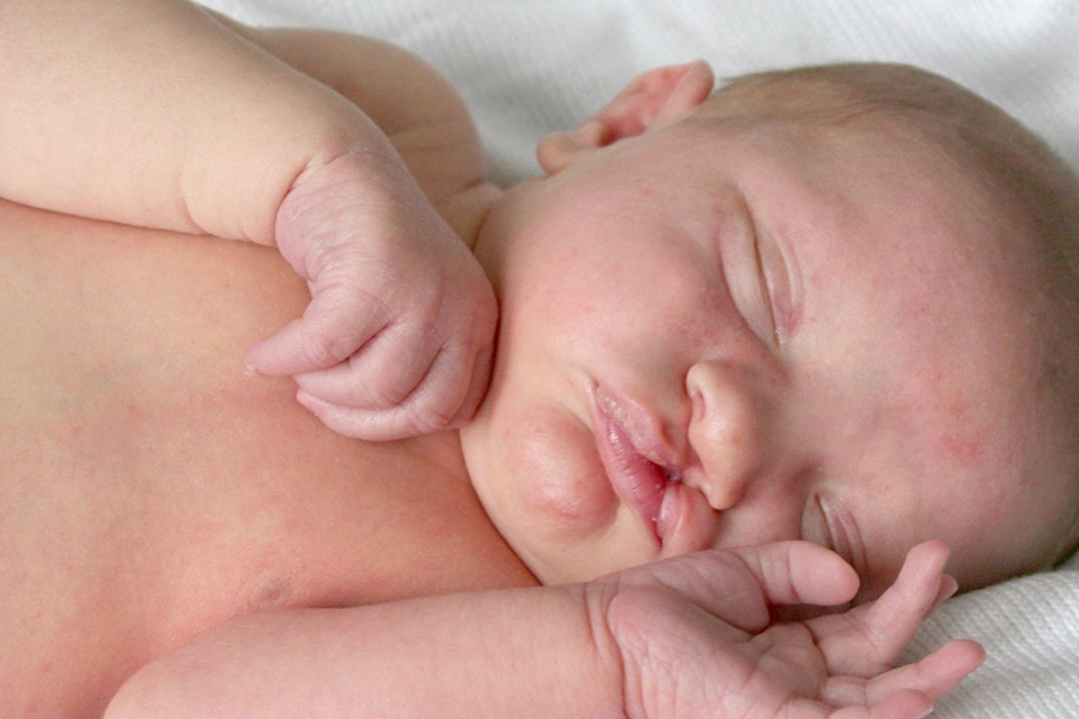 Doğumsal Anomaliler