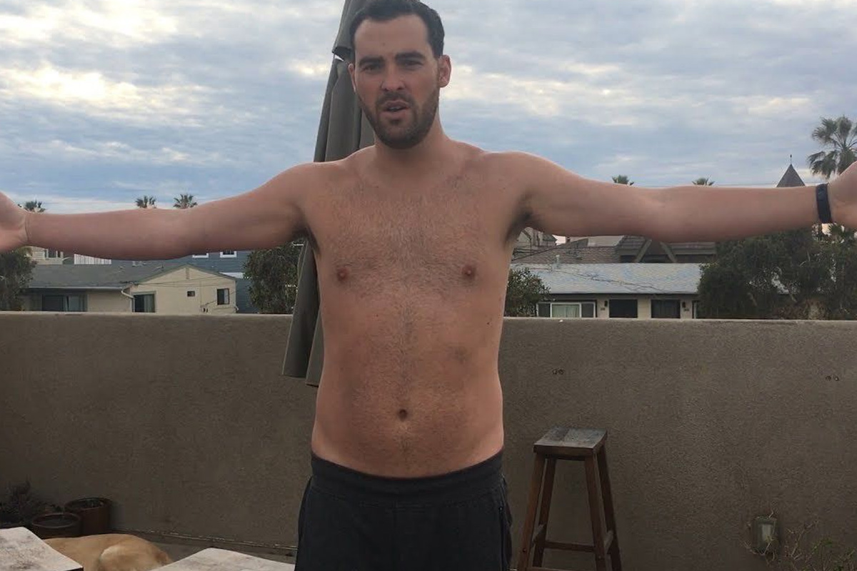 Klinefelter Sendromu