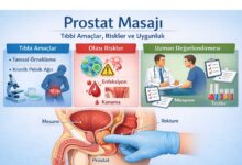 Prostat Masası ile ilgili tanımlayıcı bir görsel